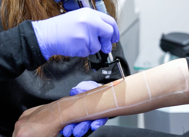 Épilation laser à Rabat chez Dr Rasha Moumna dermatologue à Agdal